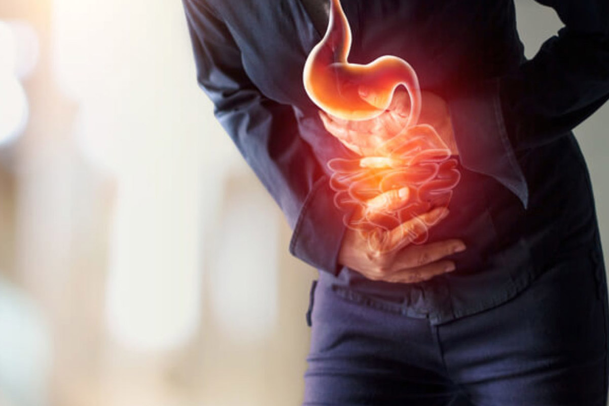 Understanding Acid Reflux: Causes, Symptoms, and Effective Treatment  Options — Gastro Florida